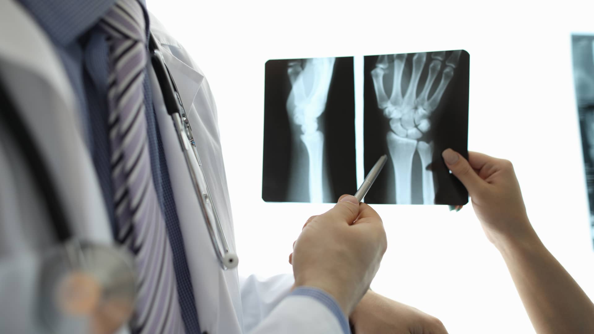 medico traumatologo revisando las radiografias de uno de sus pacientes de asisa