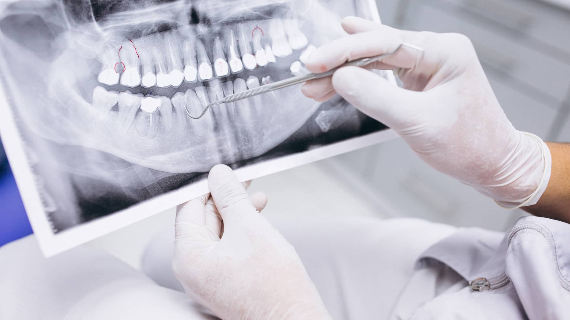 Dentista revisa una radiografía de un paciente cuya consulta estaba cubierta por su poliza de seguro dental